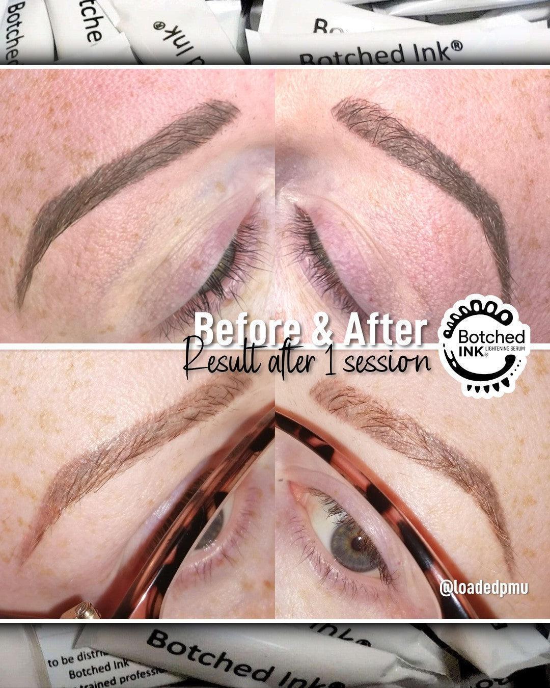 Botched Ink saline tattoo removal for microblading PMU permanent makeup eyebrow lip blush