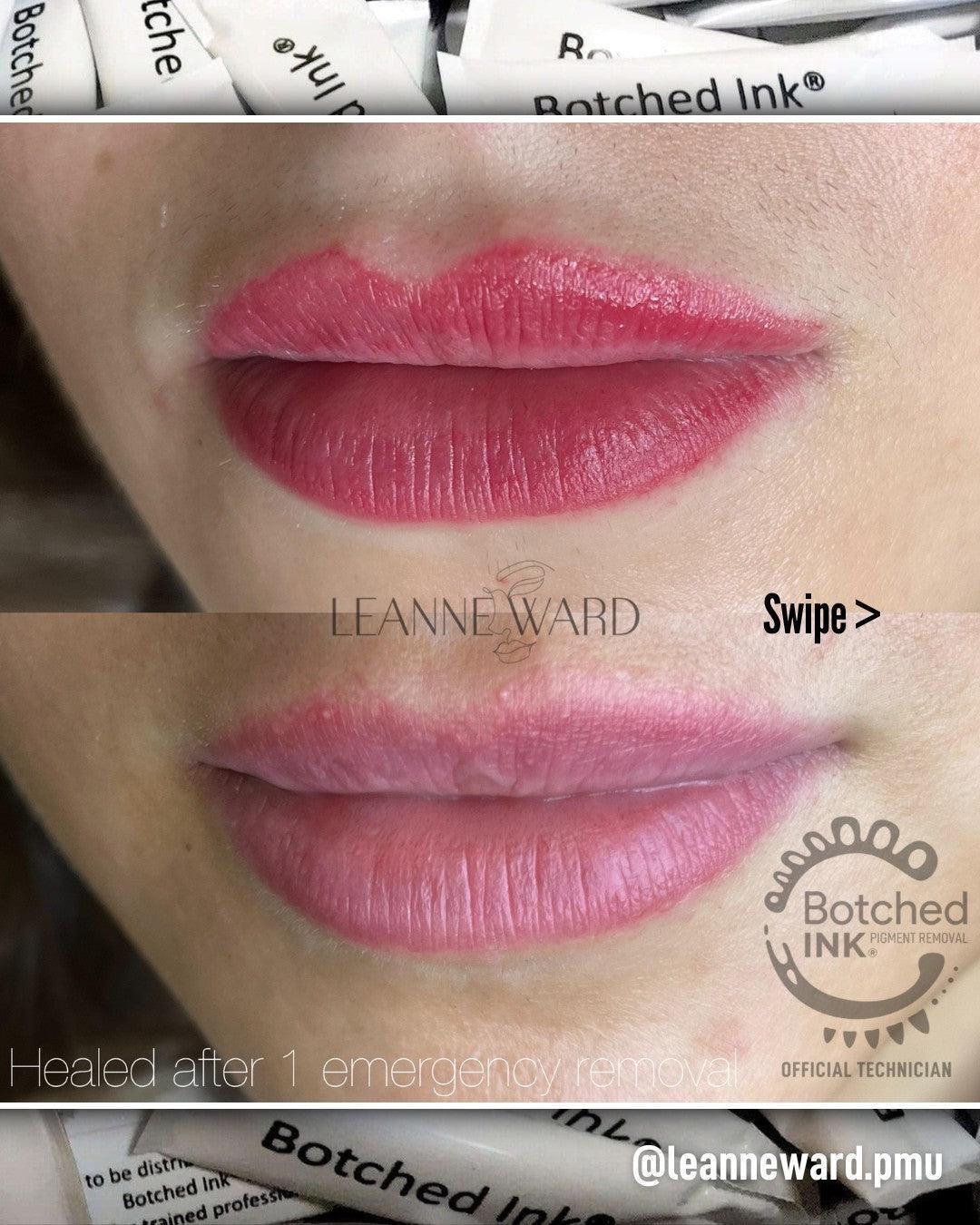 Botched Ink saline tattoo removal for microblading PMU permanent makeup eyebrow lip blush