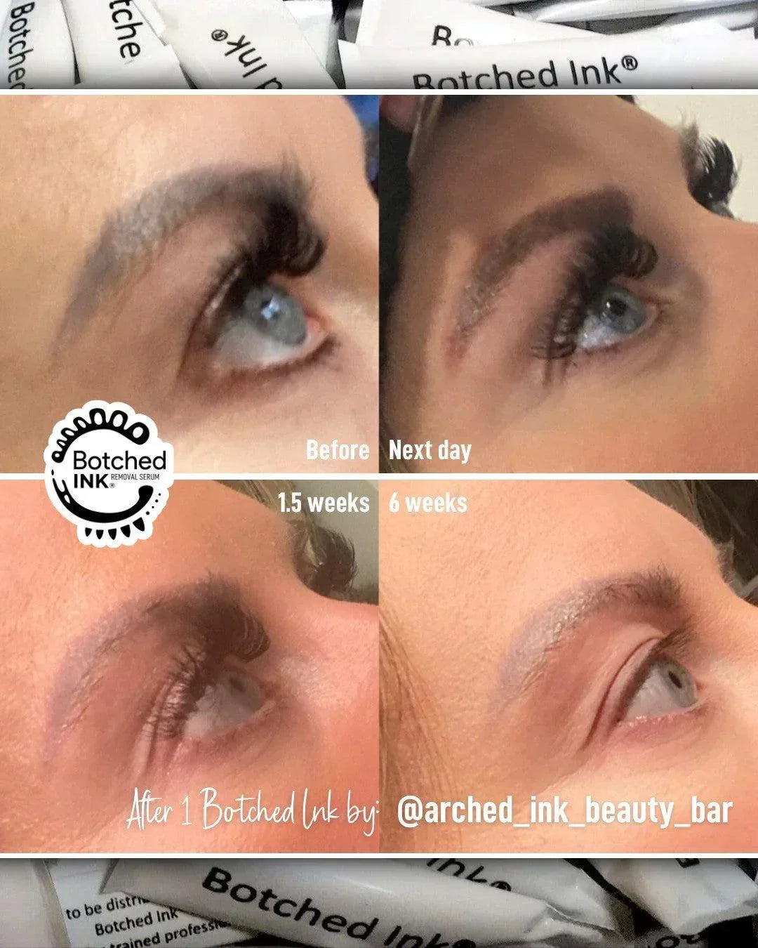 Botched Ink saline tattoo removal for microblading PMU permanent makeup eyebrow lip blush