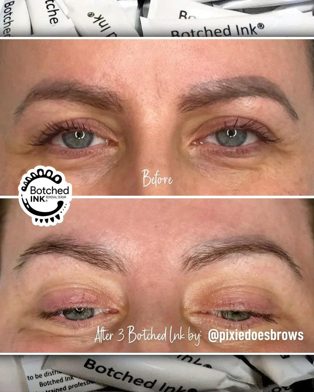 Botched Ink saline tattoo removal for microblading PMU permanent makeup eyebrow lip blush