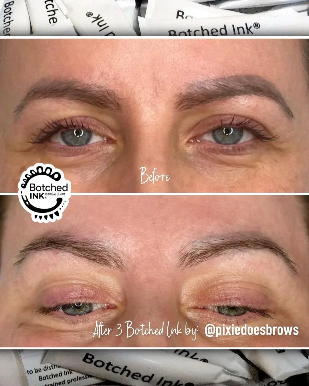 Botched Ink microblading and PMU eyebrow tattoo removal saline