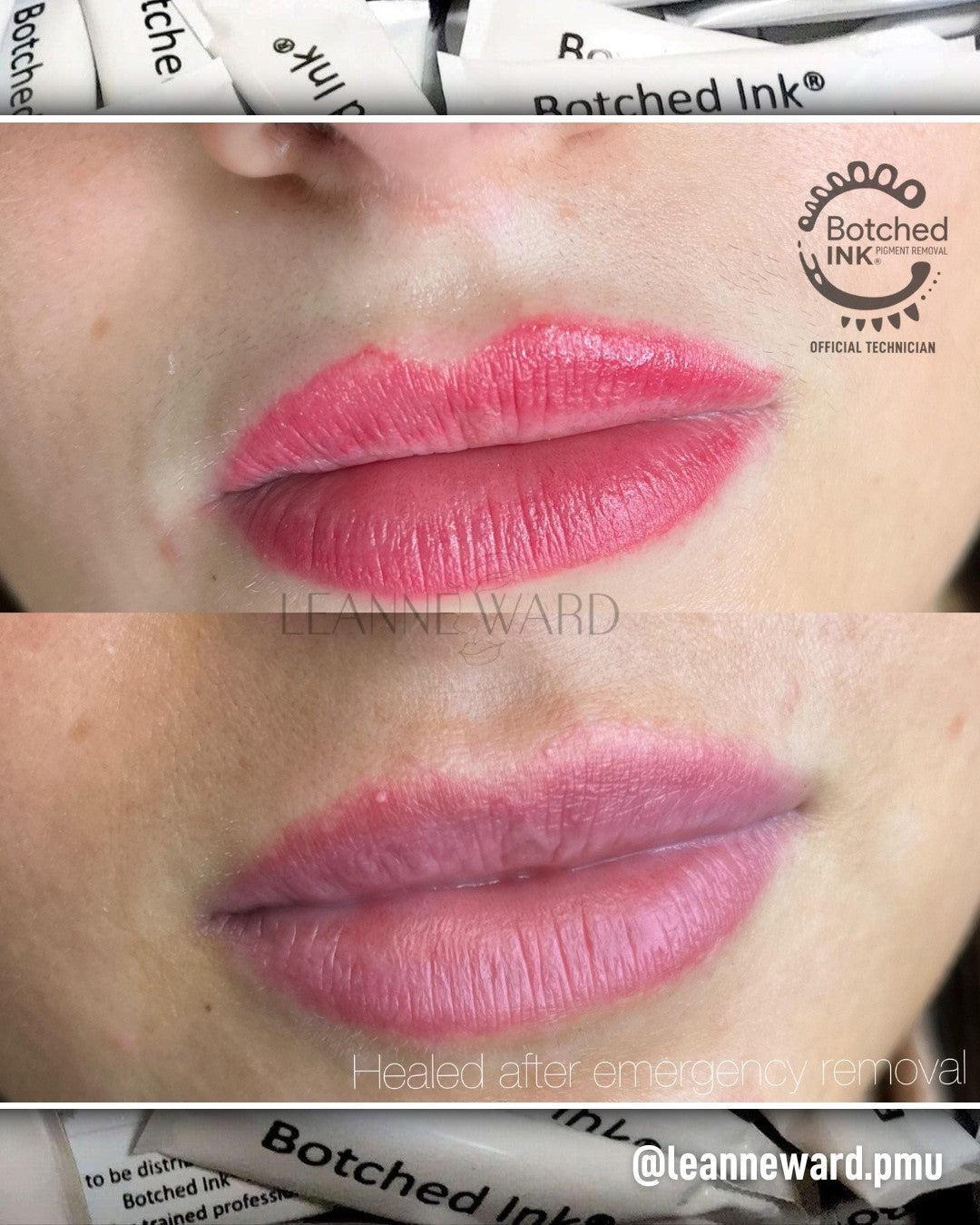 Botched Ink microblading and PMU eyebrow tattoo removal saline
