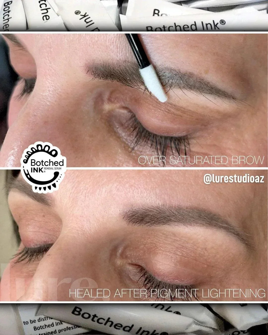 Botched Ink saline tattoo removal for microblading PMU permanent makeup eyebrow lip blush