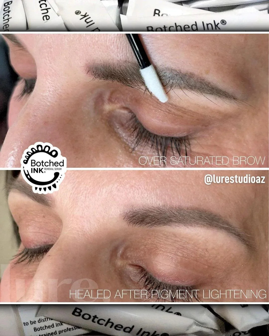 Botched Ink microblading and PMU eyebrow tattoo removal saline