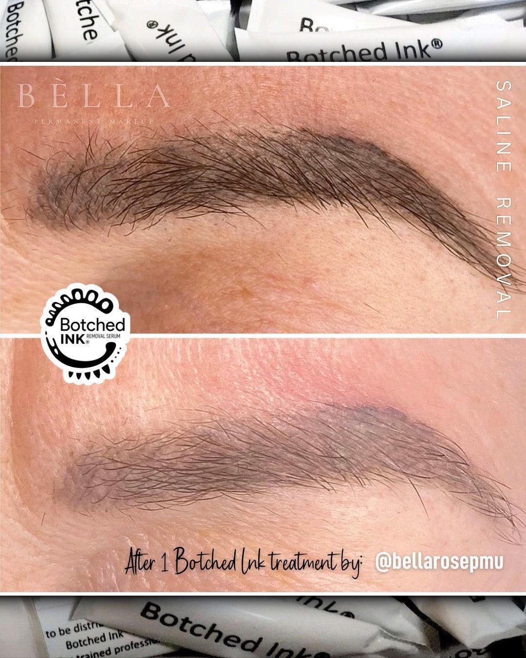 Botched Ink saline tattoo removal for microblading PMU permanent makeup eyebrow lip blush