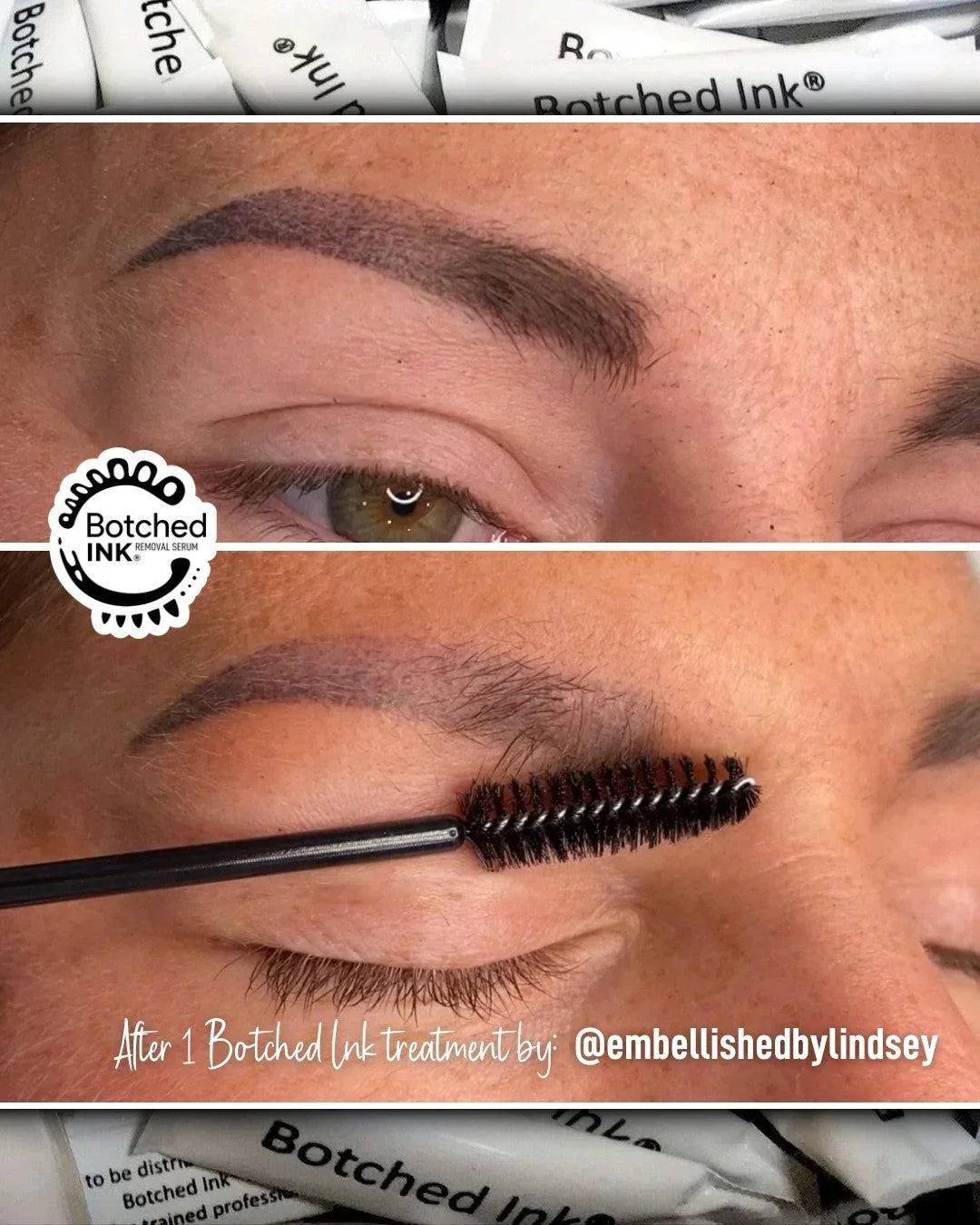 Botched Ink saline tattoo removal for microblading PMU permanent makeup eyebrow lip blush