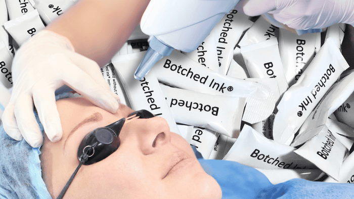 eyebrow tattoo removal saline laser