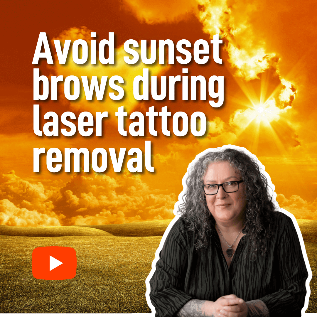 Avoid red, orange or yellow brows from laser tattoo removal – Botched Ink