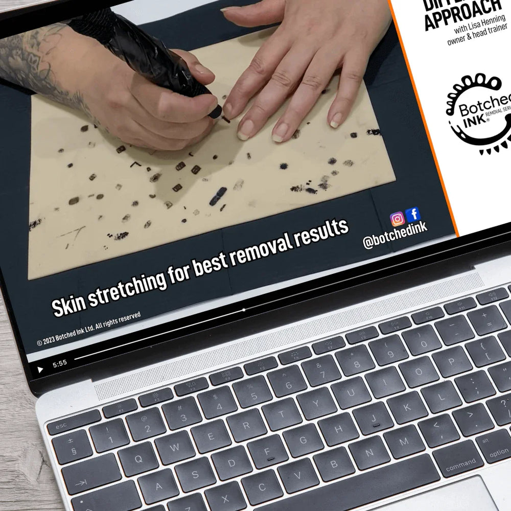 Saline Tattoo Removal with our Advanced & Exclusive Botched Ink® Serum