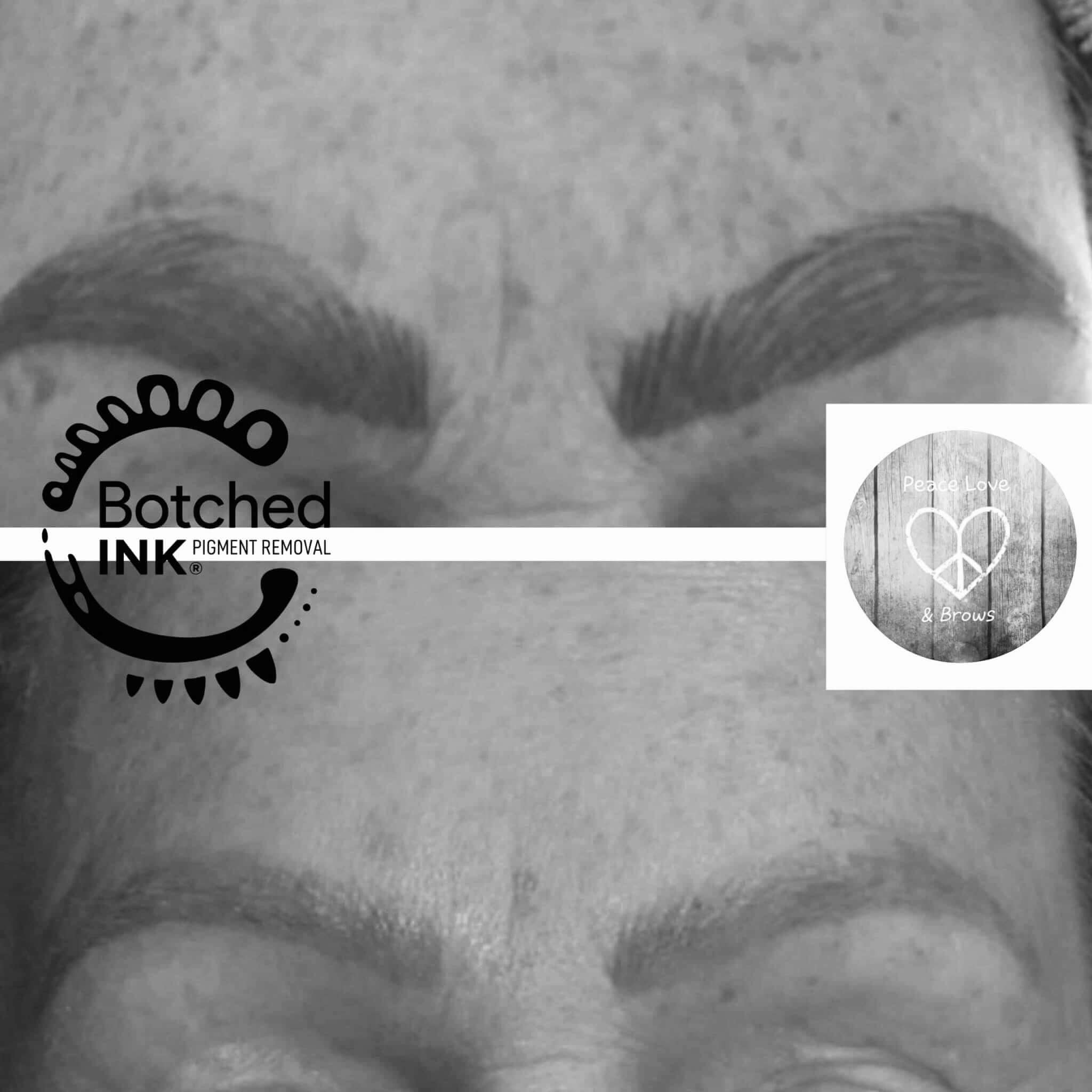 Microblading disaster get rid gone wrong removal