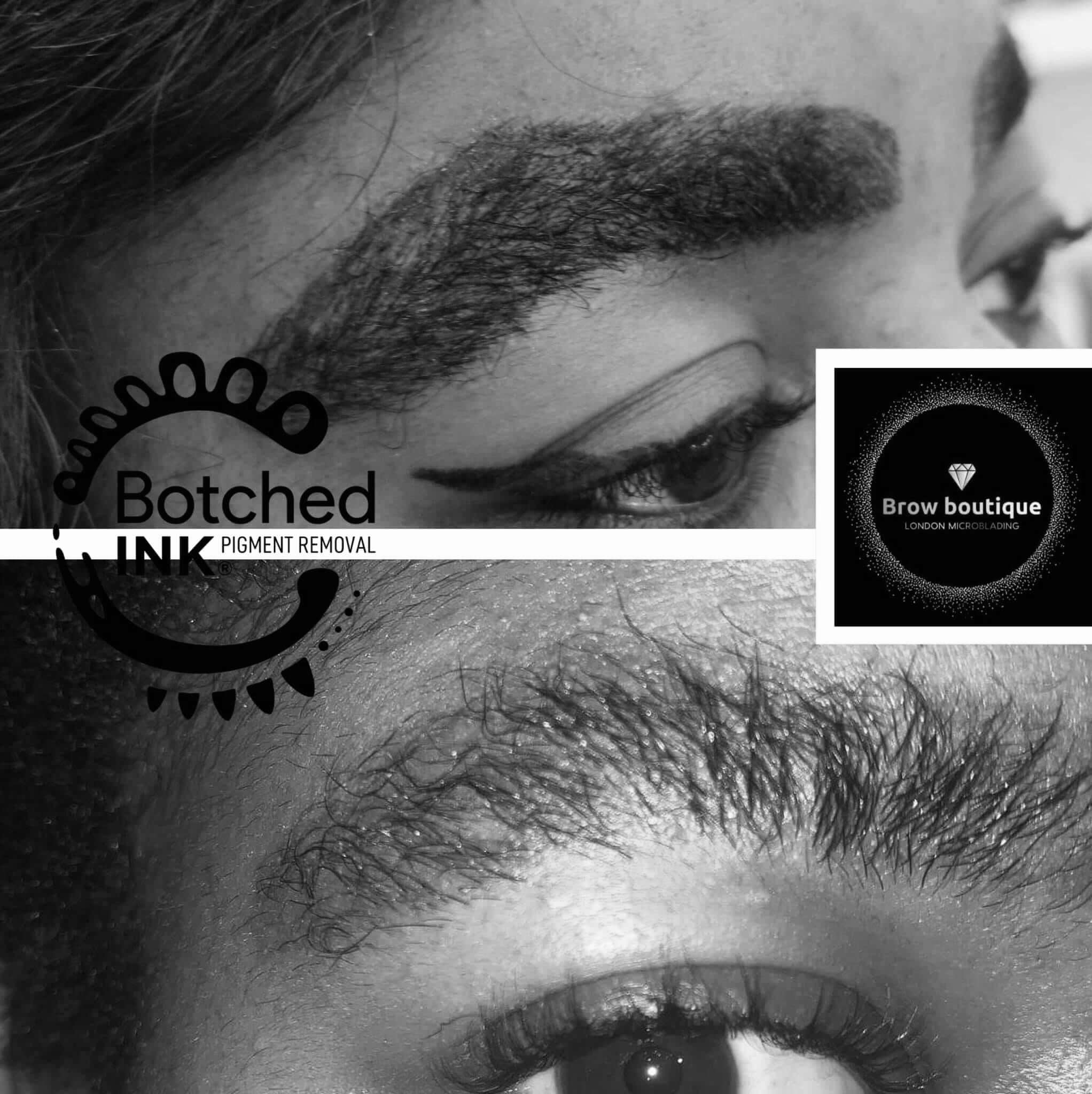 Emergency removal Microblading disaster eyebrow tattoo gone wrong get rid