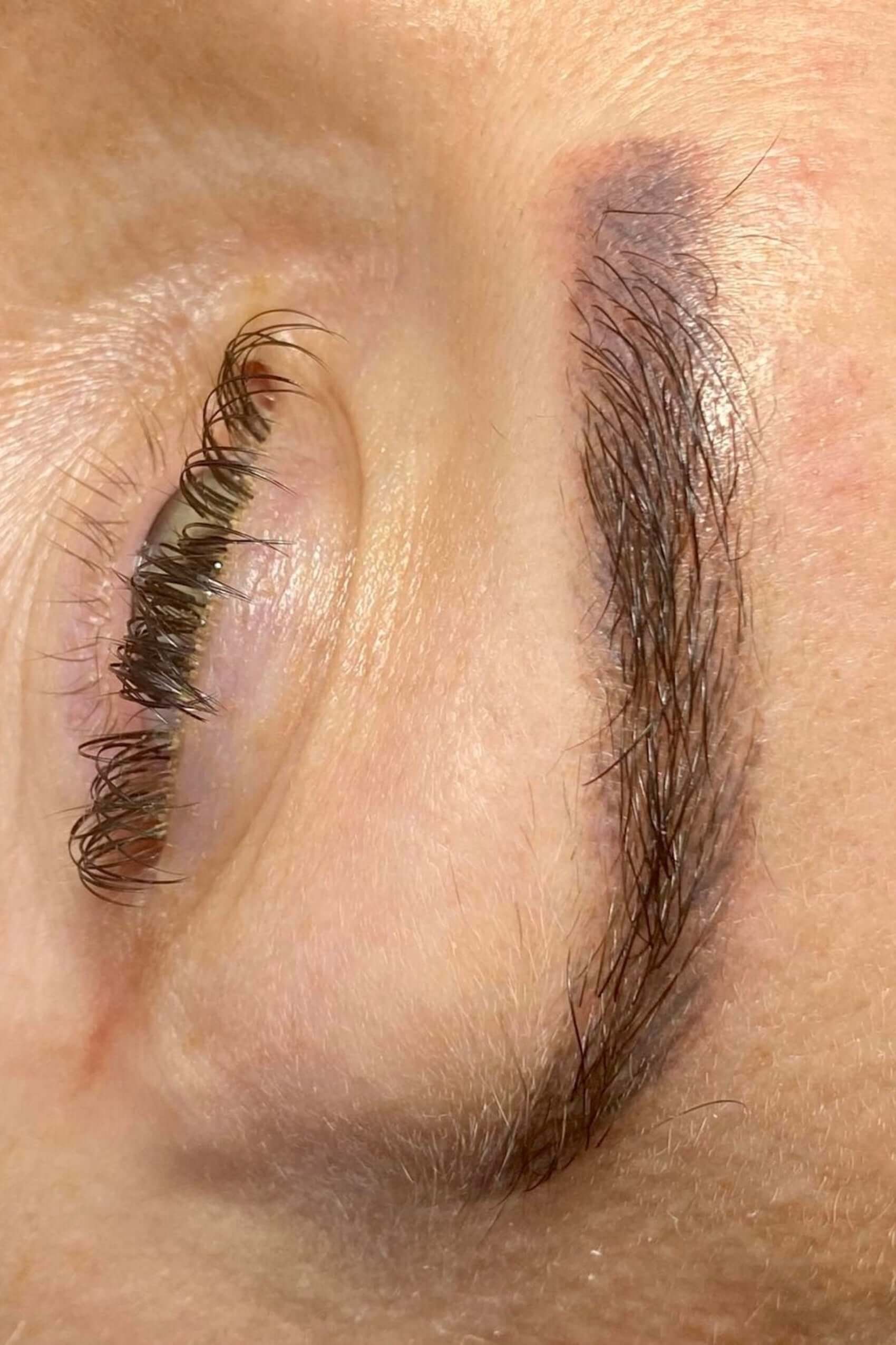 Botched Ink Rescue. Microblading Removal, Emergency or Old Work ...