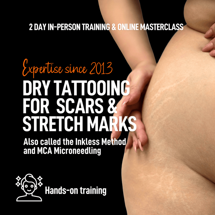 Dry Tattooing scars and stretch marks microneedling training course