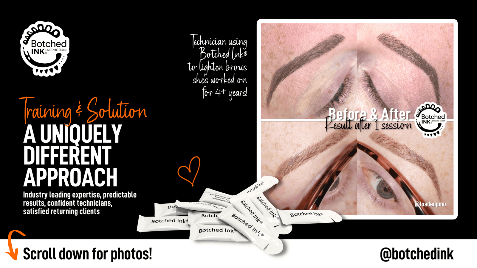 Saline Tattoo Removal Training with our Exclusive Botched Ink Serum